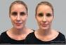 Dermaflage Waterproof Concealer Cream, Deep Thumbnail 2