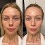 Dr. Dennis Gross C + Collagen Brighten & Firm Vitamin C Serum Thumbnail 3