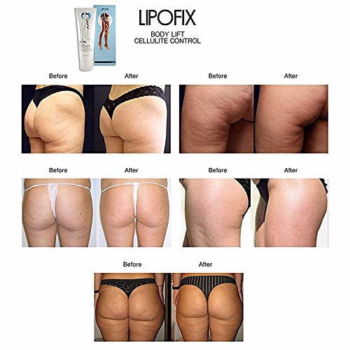 LIPOFIX Cellulite Cream Treatment 3 Pack 6