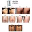 LIPOFIX Cellulite Cream Treatment 3 Pack Thumbnail 6