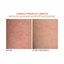 Dr Dennis Gross Alpha Beta Exfoliating Body Treatment Peel Thumbnail 6