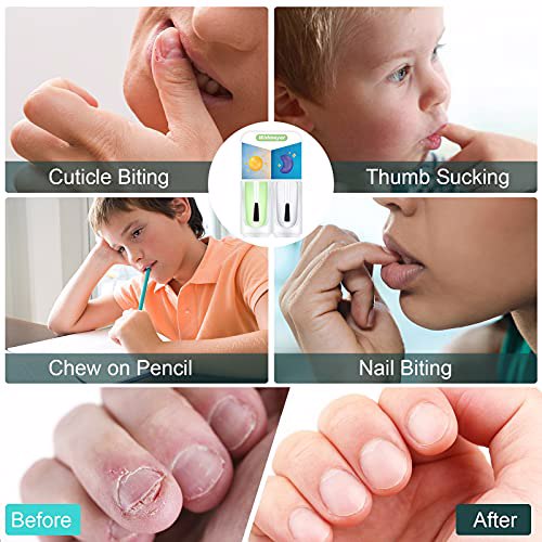 Widmeyer Nail Biting Treatment 4