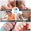 Widmeyer Nail Biting Treatment Thumbnail 4