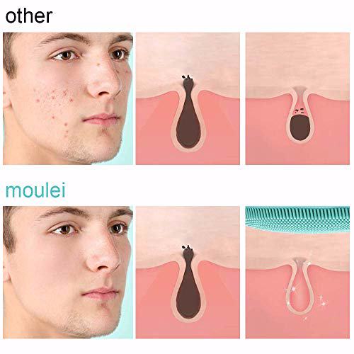 MOULEI 3 in 1 Sonic Facial Cleansing Brush 9