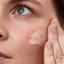Pai Skincare Chamomile & Rosehip Calming Day Cream  Thumbnail 7