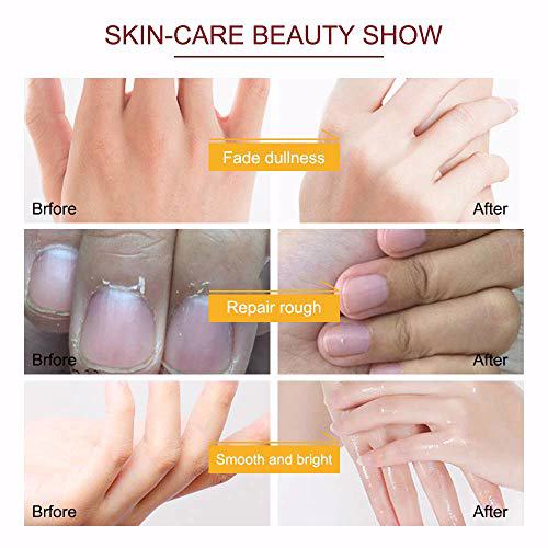 ALIVER Hand Mask, 5 Pairs 3