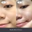 Mighty Patch Original from Hero Cosmetics - Hydrocolloid Acne Pimple Patch Thumbnail 4