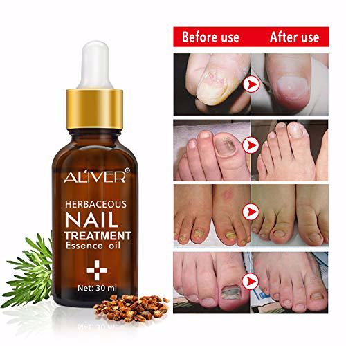 Nail Treatment Essence Oil 6