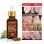 Nail Treatment Essence Oil Thumbnail 6