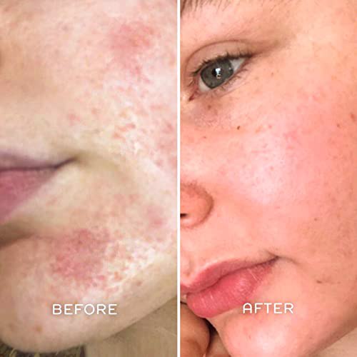 REN Clean Skincare 1 pack 4