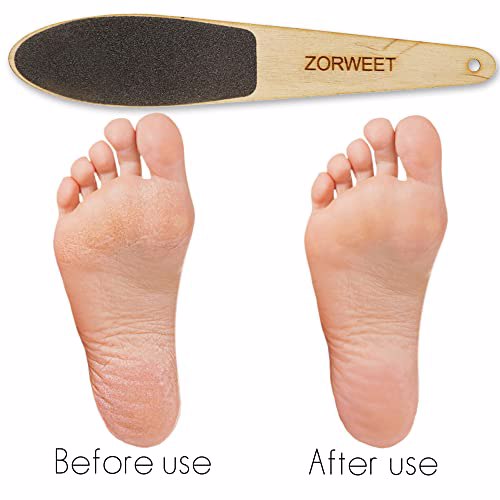 ZORWEET Pedicure Heel Rasp 4