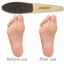 ZORWEET Pedicure Heel Rasp Thumbnail 4