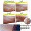 Elizavecca Foot Peel 1 Foot Pack Thumbnail 5