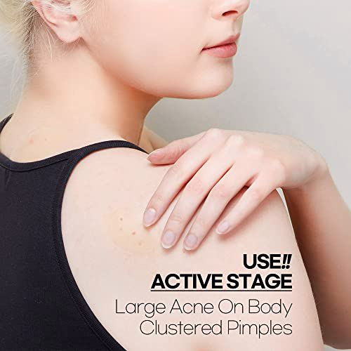 HARUTO Acne Pimple Patch XL10 patches 3