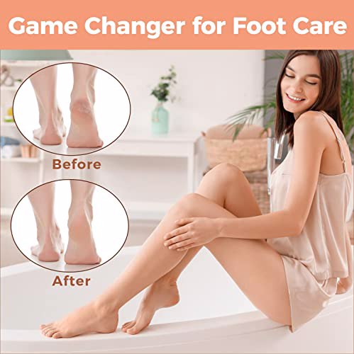 Foot File Foot Scrubber Pedicure Golden 7
