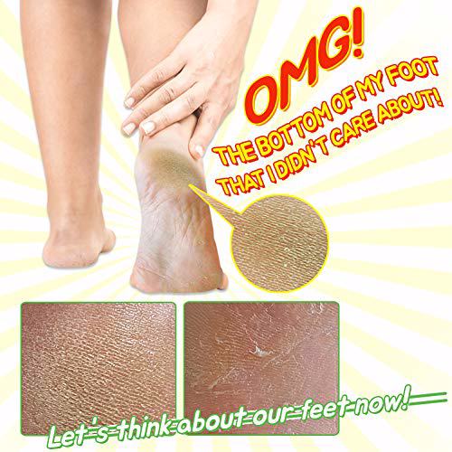 Elizavecca Foot Peel 1 Foot Pack 4