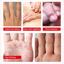 ALIVER Hand Mask, 3 Pairs Hand Moisturizing Gloves B Thumbnail 3