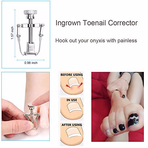 Bcabo Upgraded 8Pcs/set Ingrown Toenail Tools Kit 5