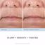 NuFACE FIX Line Smoothing Device Targeted Microcurrent Treatment Thumbnail 5