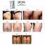 LIPOFIX Anti Cellulite Cream Treatment 2 Pack Thumbnail 6