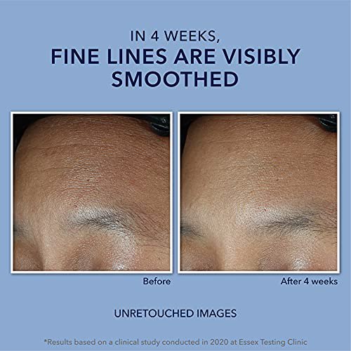 RoC Retinol Correxion Max Daily Hydration Anti-Aging Daily Face Moisturizer 7