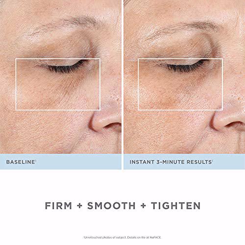NuFACE FIX Line Smoothing Device Targeted Microcurrent Treatment 4