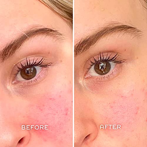 REN Clean Skincare Evercalm Redness Relief Serum 3