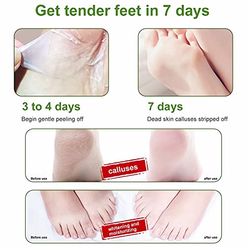 NewFoot Foot Peel Mask 3