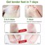 NewFoot Foot Peel Mask Thumbnail 3