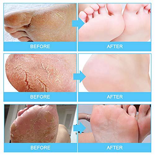 GUOYUAN Foot Peel Mask 8