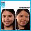 Maybelline Dream Pure Skin Clearing BB Cream, 8-in-1 Skin Perfecting Medium/Deep Thumbnail 5