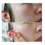 Elizavecca Witch Piggy Hell Pore Galactomyces Pure Ample 50Ml Thumbnail 7