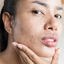 Neutrogena Stubborn Texture Daily Acne Gel Facial Cleanser Thumbnail 6