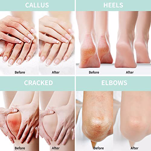 Grocerism Urea Cream Moisturizing Socks 6
