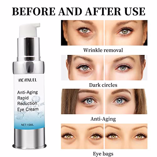 VICVINUEL Eye Cream for Dark Circles and Puffiness 4