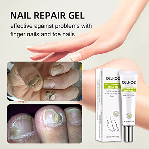 efero 2PCs Nail Repair Cream 2