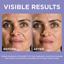 L’Oreal Paris 1.5% Pure Hyaluronic Acid Serum Thumbnail 5