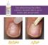 ProLinc Cuticle Eliminator  Thumbnail 3